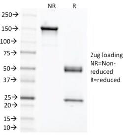 CEACAM5/CD66e Antibody (C66/1291), Novus Biologicals 20&mu;g; Unlabeled:Antibodies,